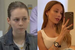 Ester Expósito: Antes y después, aumento de mentón y rinoplastia