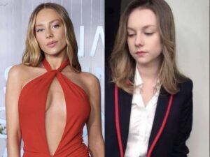 Ester Expósito: Antes y después, bichetomía y relleno de pómulos