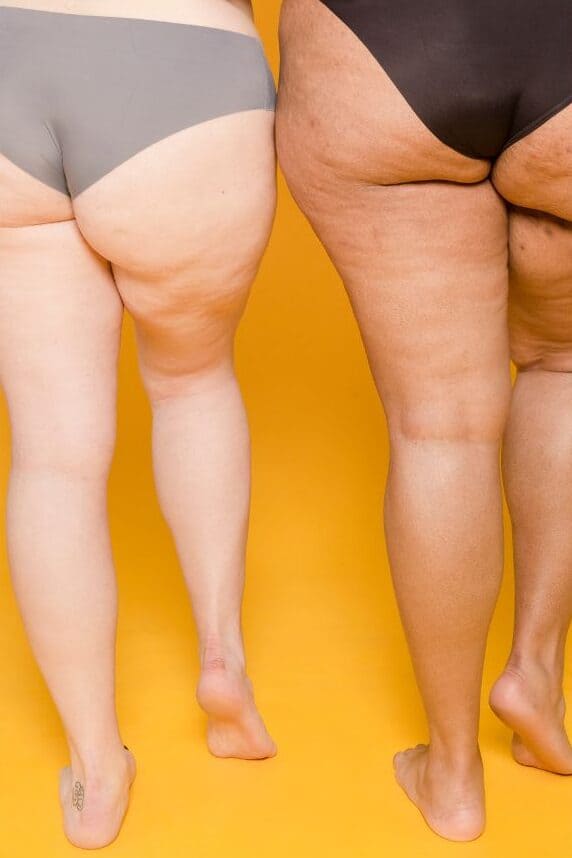 visita eliminar celulitis